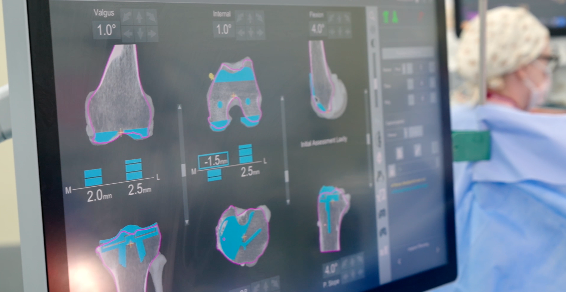 A screen displays parts of a knee.