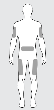 Diagram of body with areas of adequate subcutaneous fat