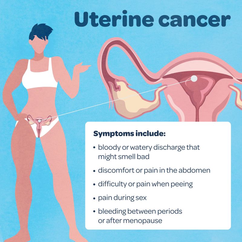 A graphic image showing the symptoms of uterine cancer, reading: bloody or watery discharge that might smell bad ·        discomfort or pain in the abdomen ·        difficulty or pain when peeing  ·        pain during sex