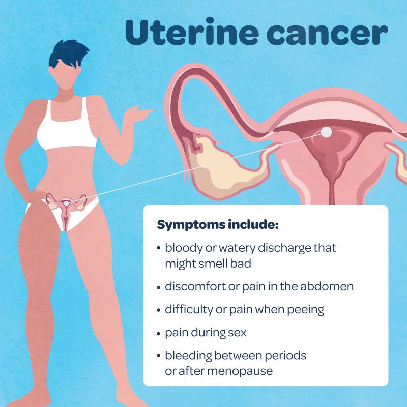 A graphic image showing the symptoms of uterine cancer, reading: bloody or watery discharge that might smell bad · discomfort or pain in the abdomen · difficulty or pain when peeing · pain during sex