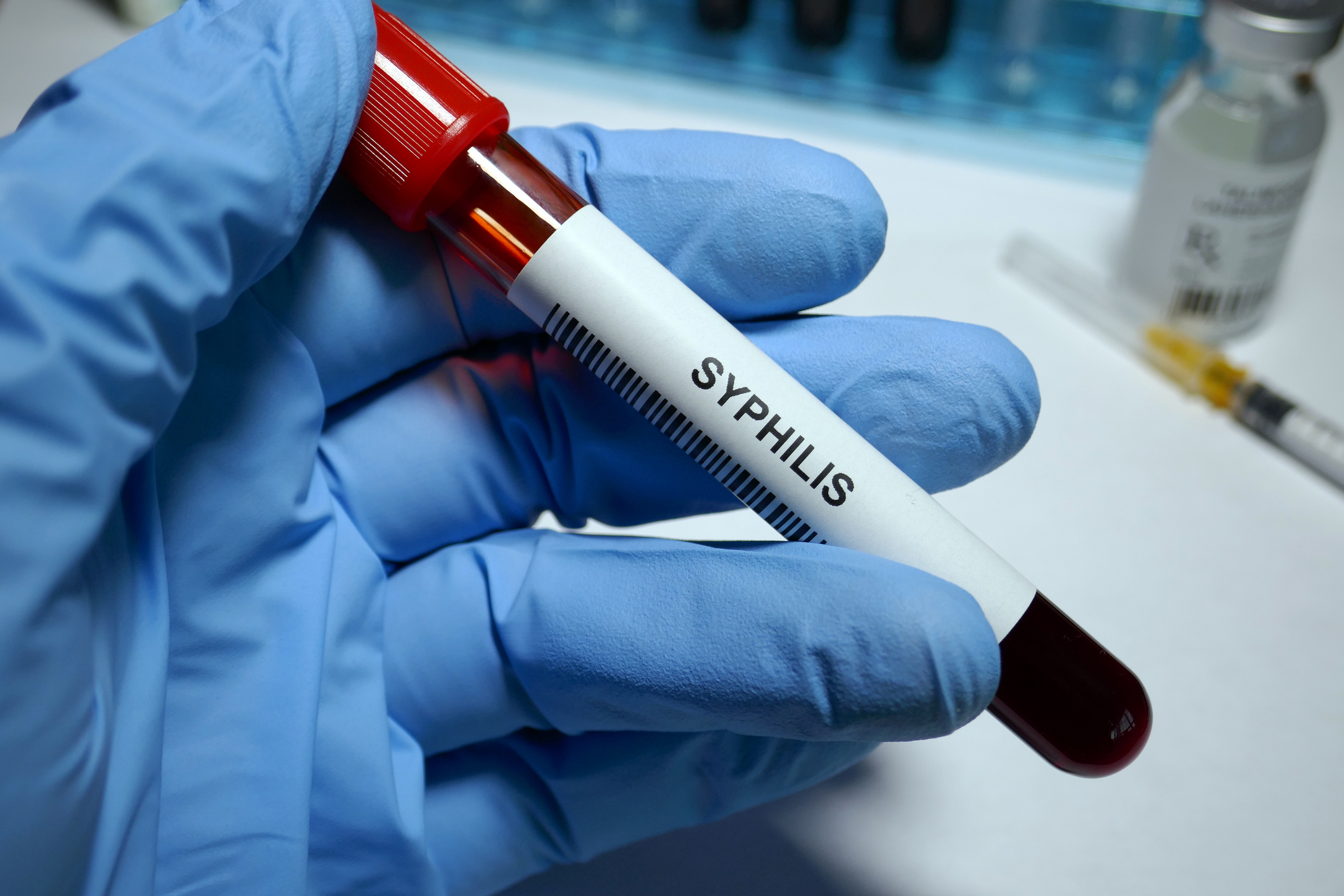 A gloved hand holding a vial labelled 'Syphilis