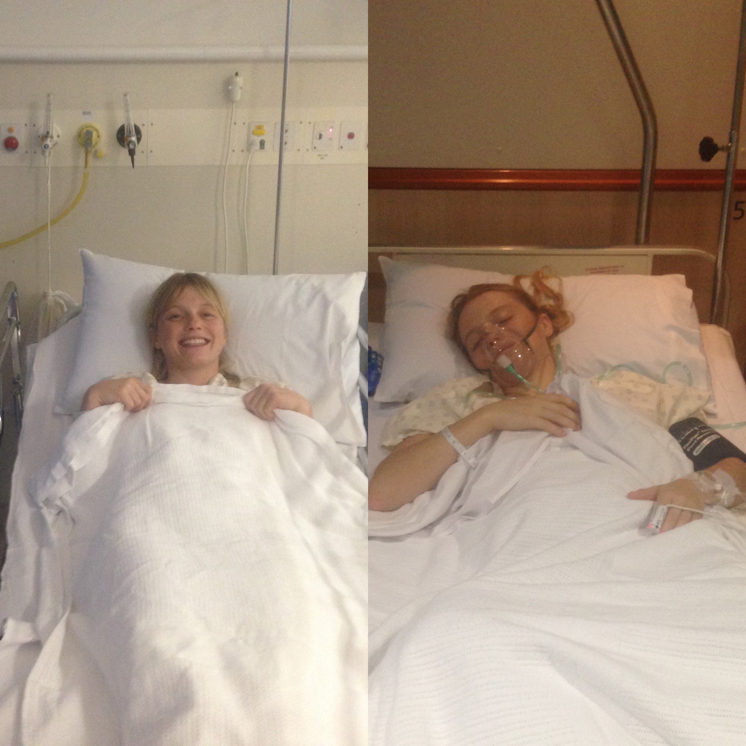 A photo of Kate before and after surgery.