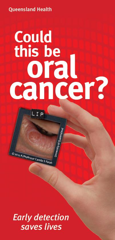 Image of Oral Cancer brochure