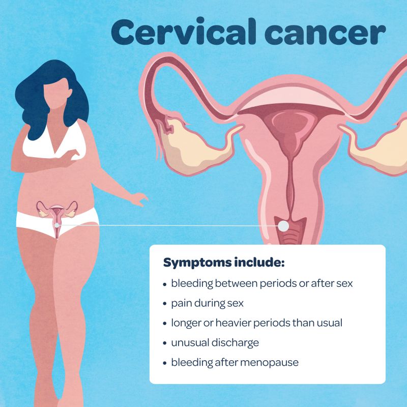 A graphic image showing the symptoms of cervical cancer reading:  bleeding between periods or after sex ·        pain during sex ·        longer or heavier periods than usual ·        unusual discharge  ·        bleeding after menopause 