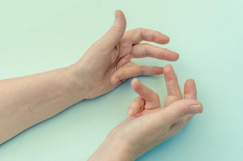 A pair of woman's hands against a pale turquoise background. The little finger on one hand and and ring finger on the other are pulled back parallel with the palm due to Dupuytren's contracture