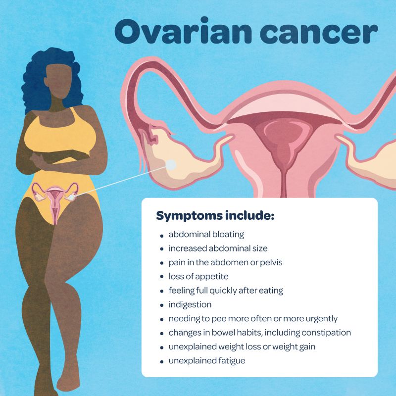 A graphic image showing the symptoms of ovarian cancer reading: abdominal bloating · increased abdominal size · pain in the abdomen or pelvis · loss of appetite · feeling full quickly after eating · indigestion · needing to pee more often or more urgently · changes in bowel habits, including constipation · unexplained weight loss or weight gain, unexplained fatigue 