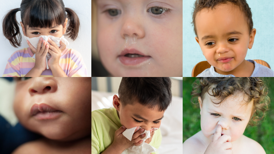 Six different images of children with runny noses or blowing their noses