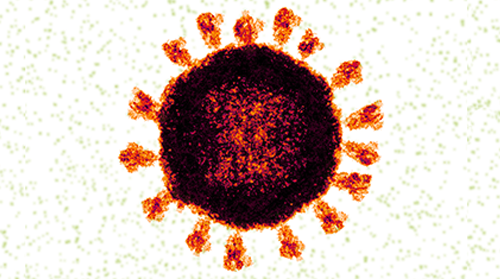 An electron microscope image of Sars-CoV-2 the virus that causes COVID-19