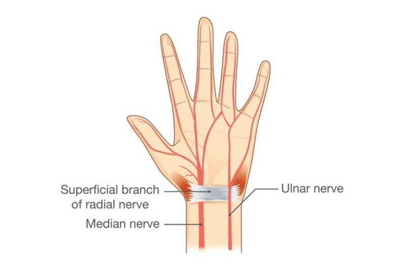 A diagram showing the nerves of the hand.